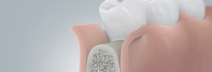 implantation_setzten1 implantation_setzten1